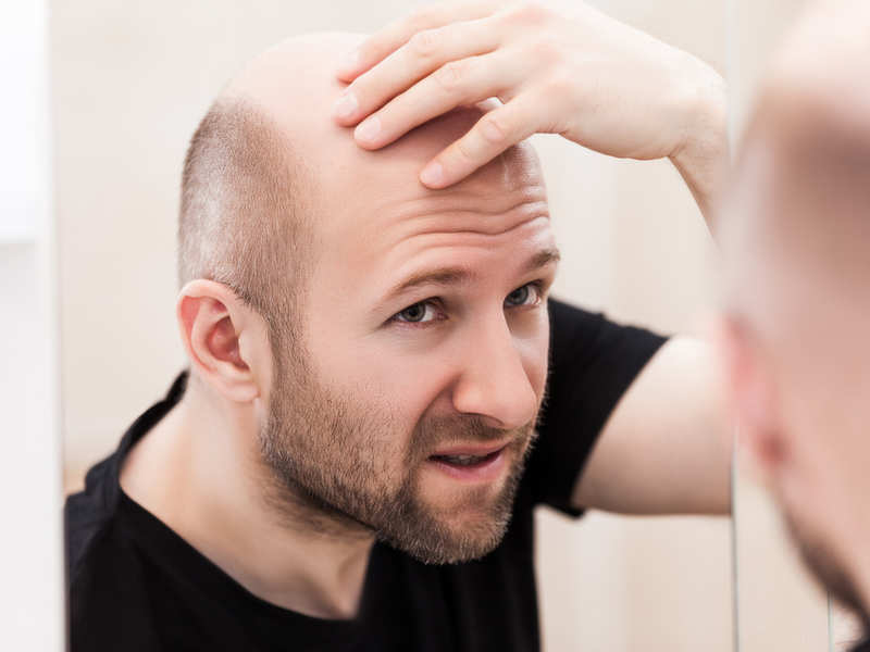 Hair loss treatment for men Clinic Dermatech 1